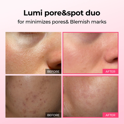 Pore & Spot Duo