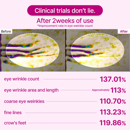 Dr. Melaxin™ Cemenrete Calcium Eye Lift Duo