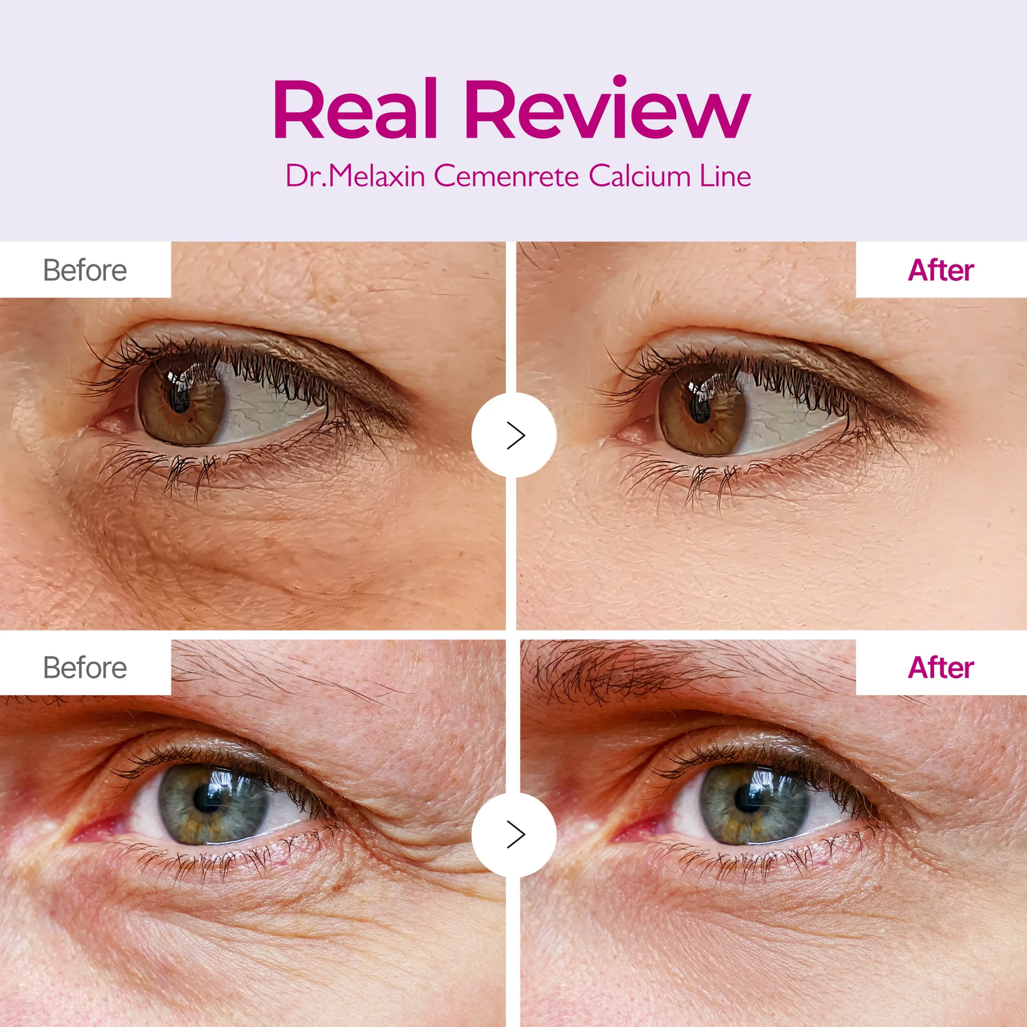 Dr. Melaxin™ Cemenrete Calcium Eye Lift Duo